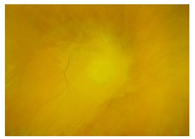 Piene - Yellow Space 514